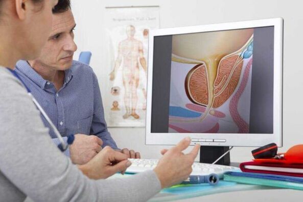 doktor berunding dengan pesakit mengenai masalah prostatitis