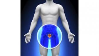 prostatitis pada seorang lelaki