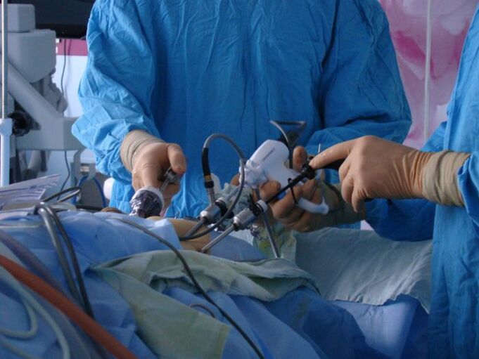 rawatan pembedahan prostatitis
