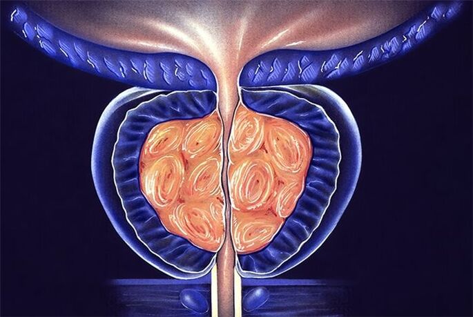 gejala dan rawatan prostatitis