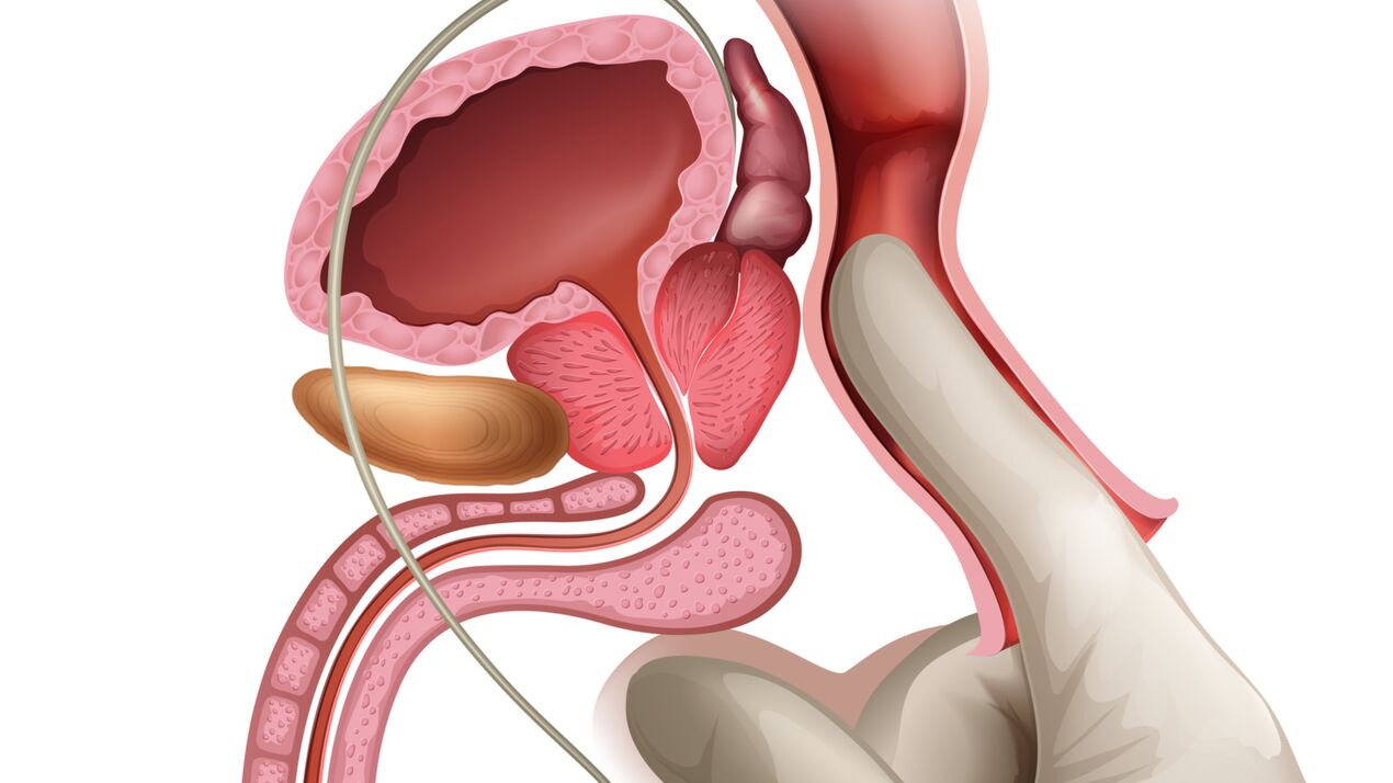 Urutan prostat adalah cara yang berkesan untuk merawat prostatitis kongestif