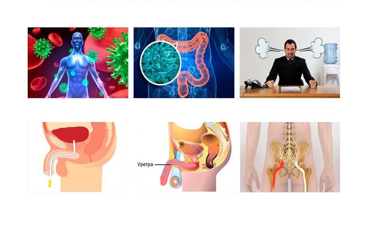 punca prostatitis
